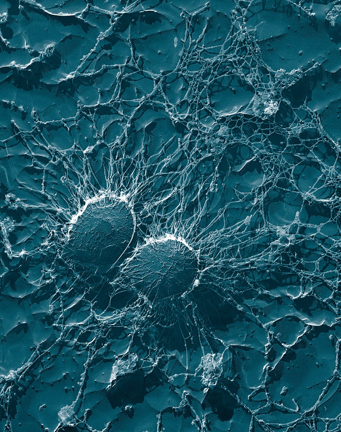 Image au microscope électronique à balayage de bactéries Staphylococcus aureus groupées en amas