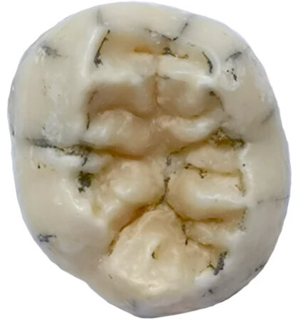 TNH2-1 mandible from Xiahe, Denisovan specimen from the Tibetan plateau