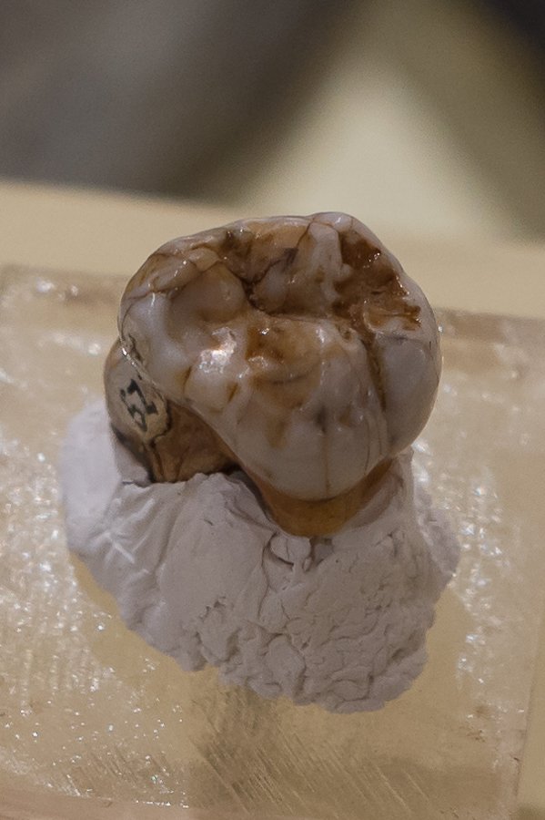 Denisovan molar from Denisova Cave