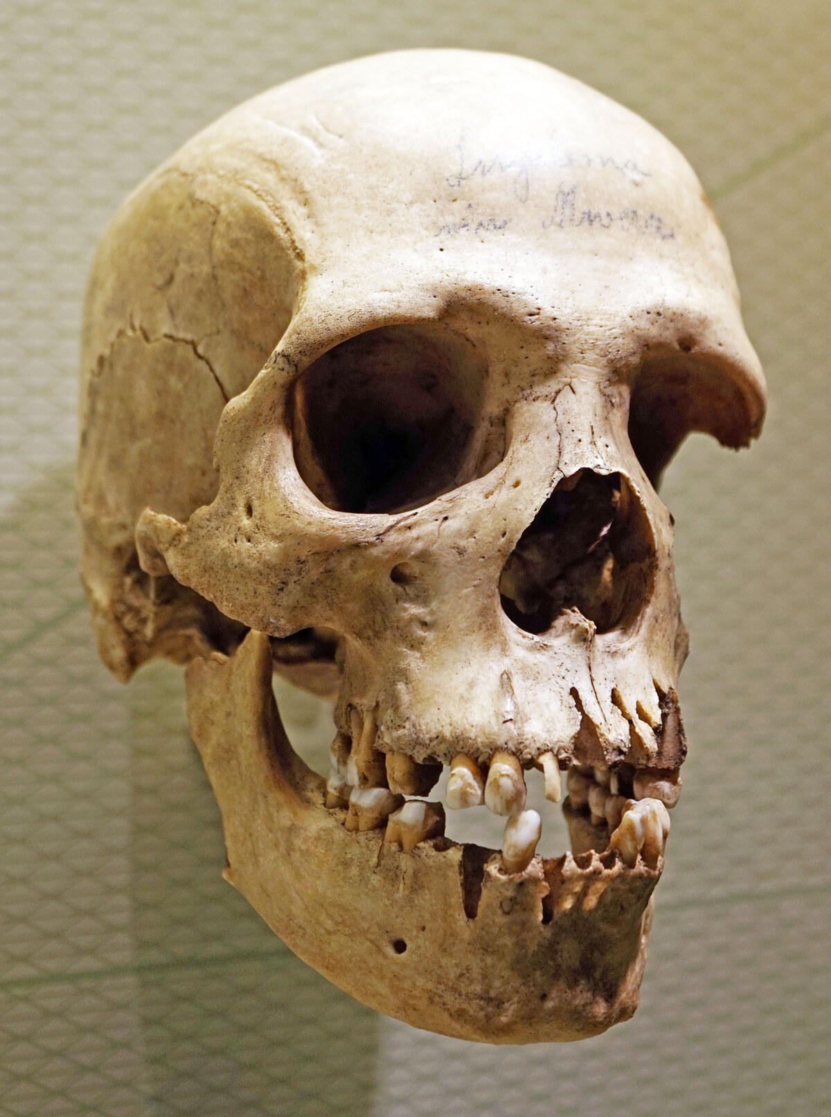 Moulage du crâne Skhul 5, vue de face