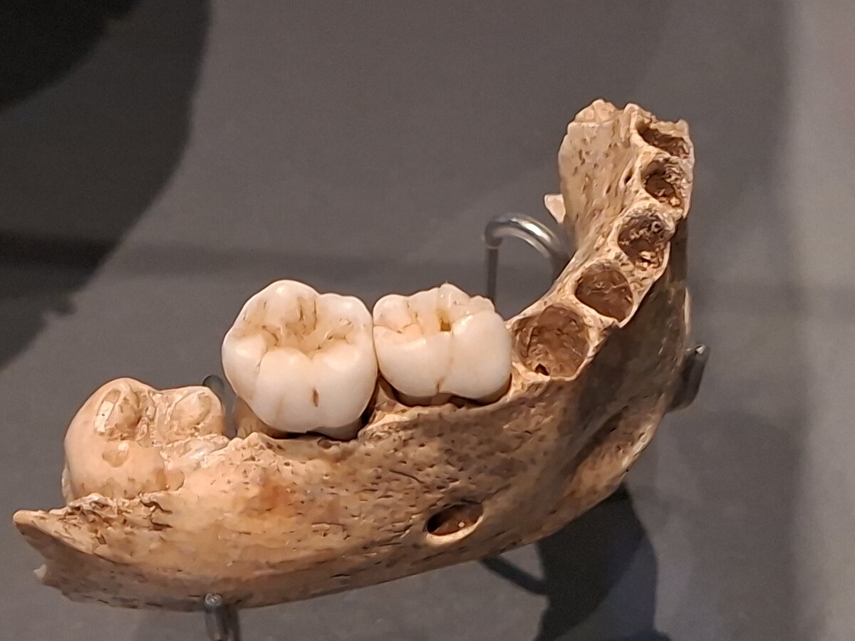 Mandibule néandertalienne montrant les dents