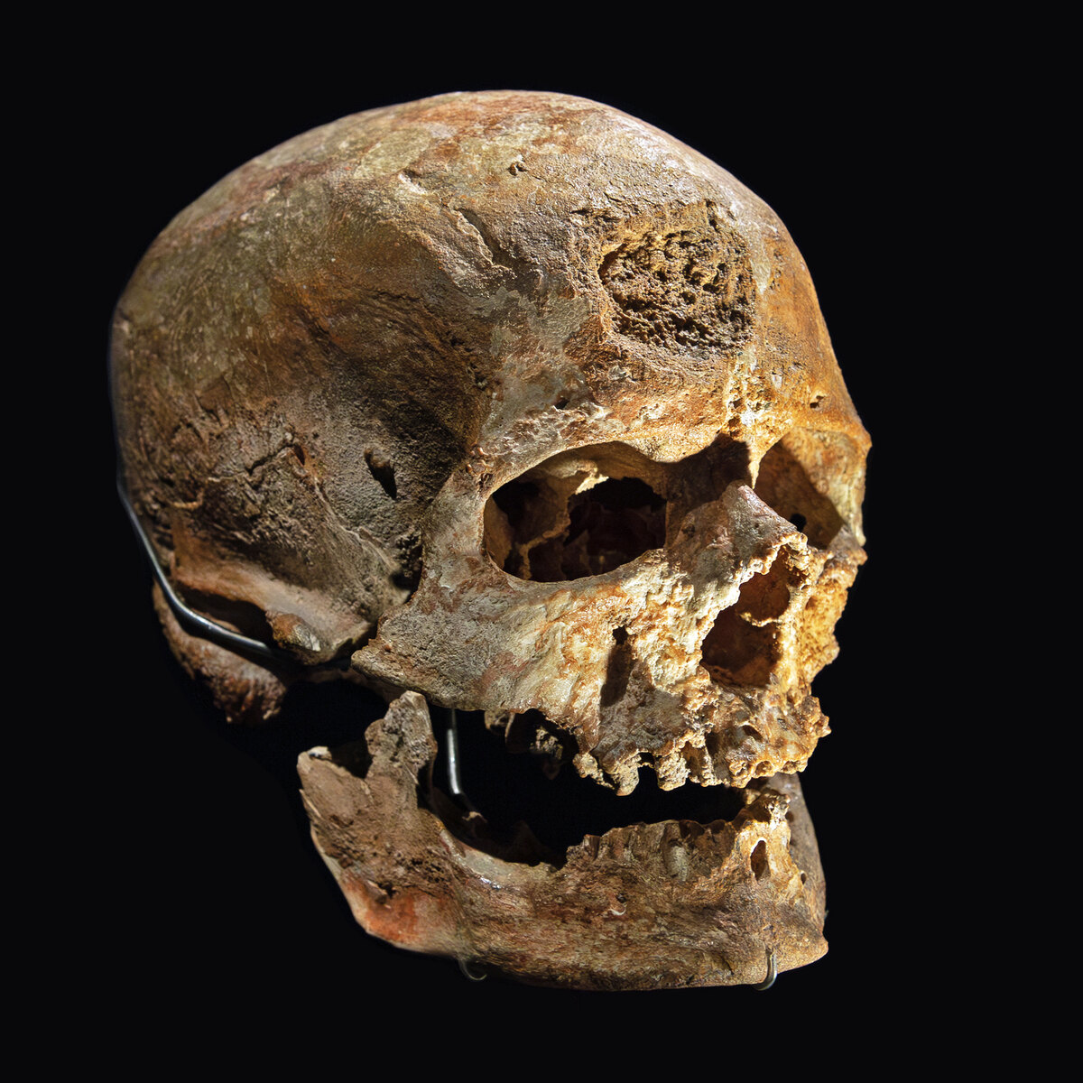 Anatomically modern Homo sapiens skull, representing Neolithic populations