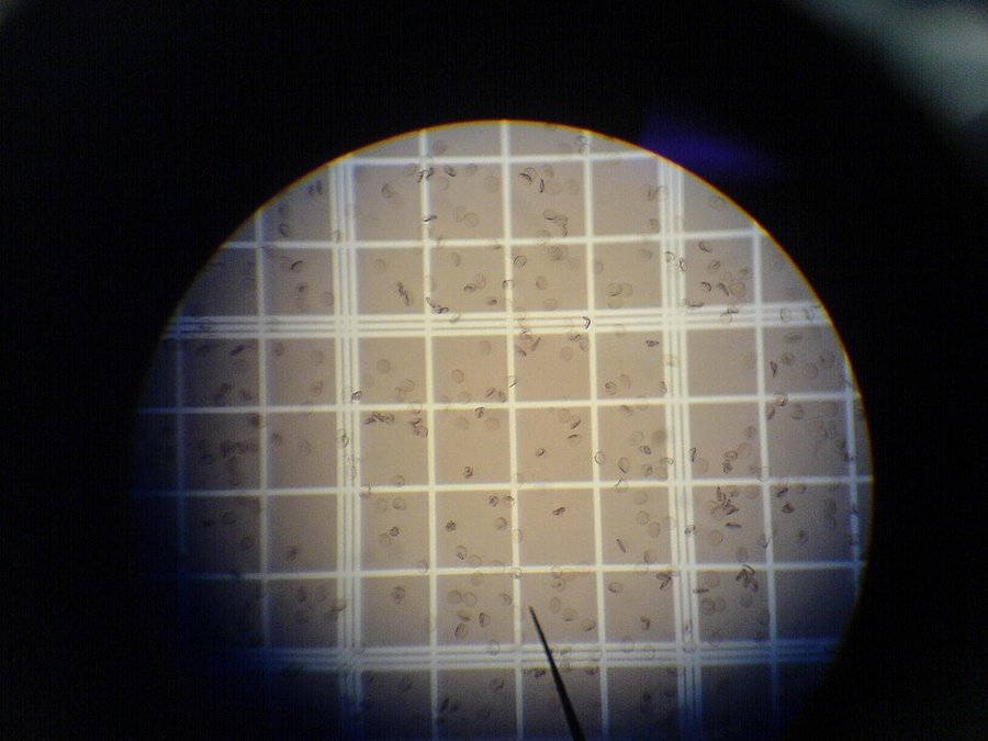 Globules rouges au microscope electronique