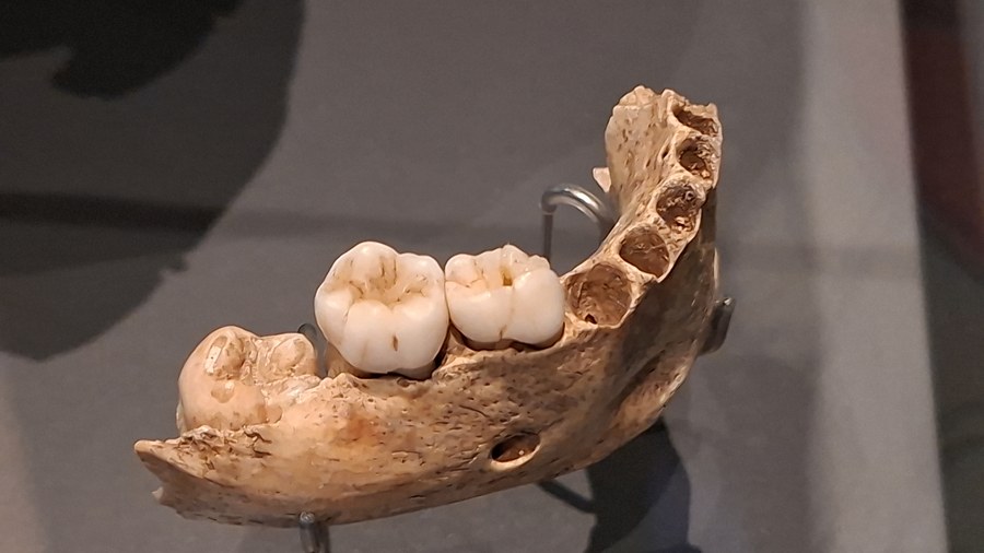 Mandibule neandertalienne avec dents, vue comparative